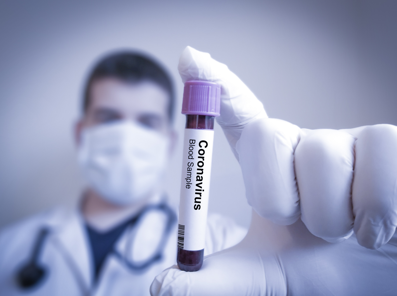 Ein Arzt im Hintergrund in weißem Kittel und mit Maske hält ein Röhrchen nach vorne, auf dem Coronavirus Blood Sample steht